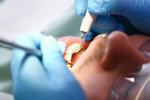Best Walk-In Emergency Dental Services in Manche Village, CA