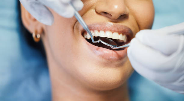 Best Weekend Emergency Dental Services in Manche Village, CA