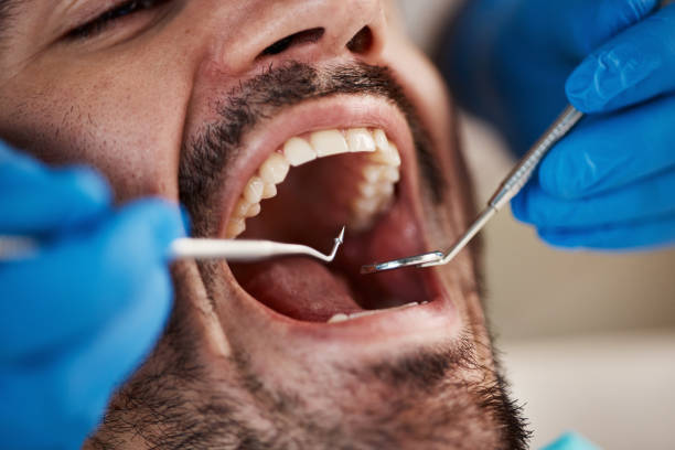 Best Broken or Chipped Tooth Repair in Manche Village, CA