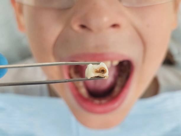 Best Emergency Care for Gum Disease in Manche Village, CA